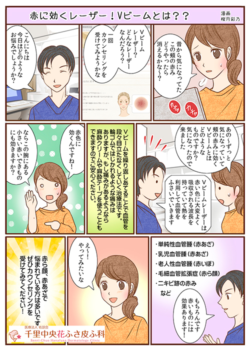 Vビーム漫画