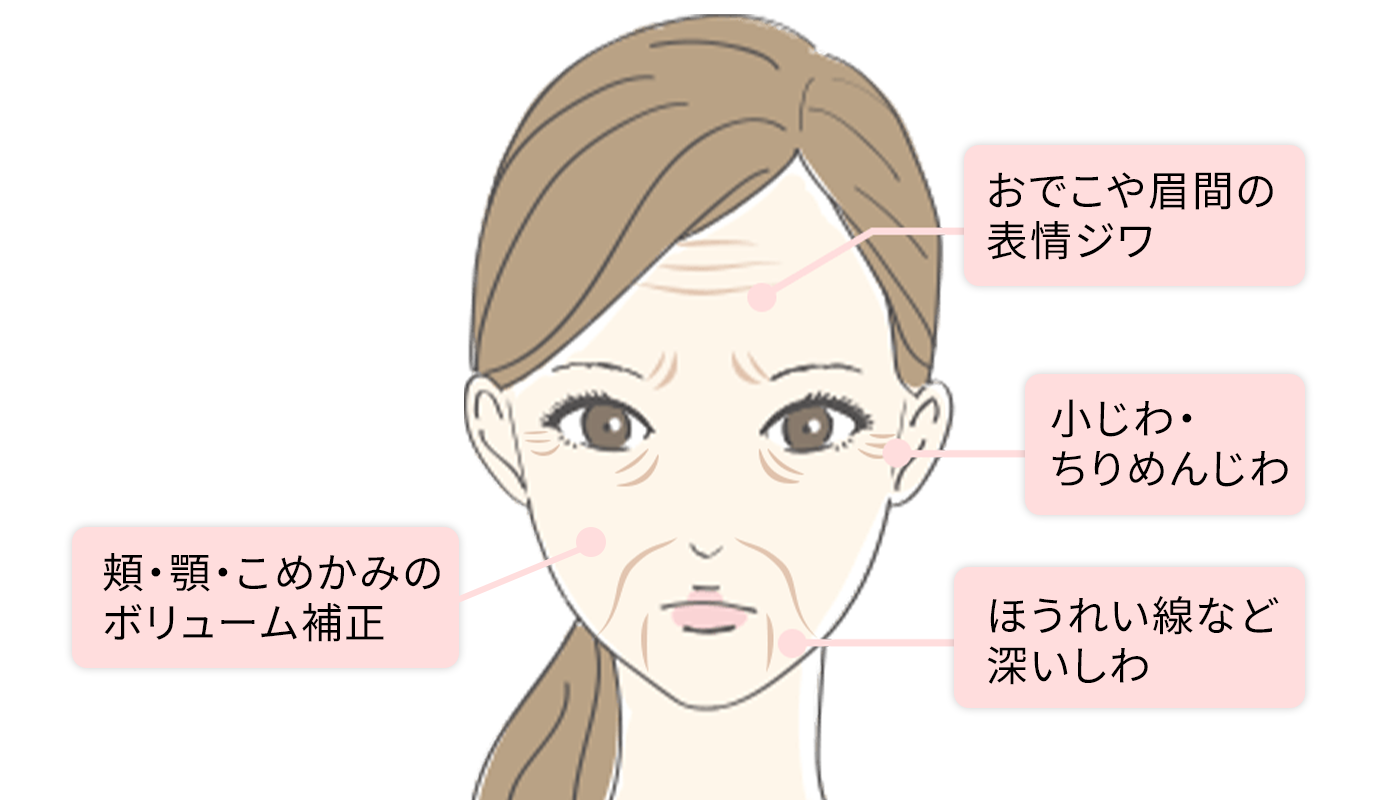 たったの1.6%