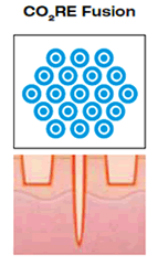 CO2RE-Fusion