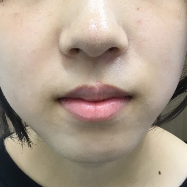 保険適用の手術